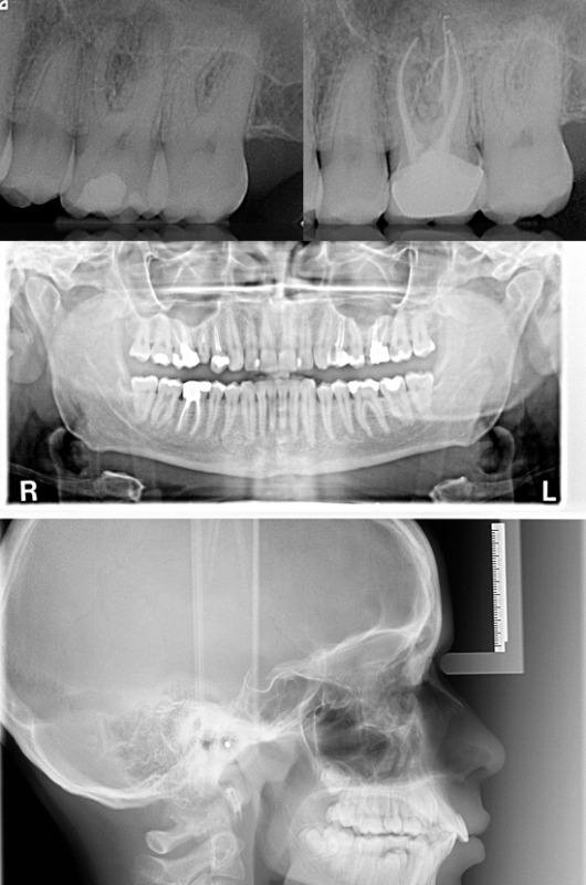  Tipi di Radiografia Dentale: